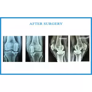 Rajnibhai Patel 53 Years Old