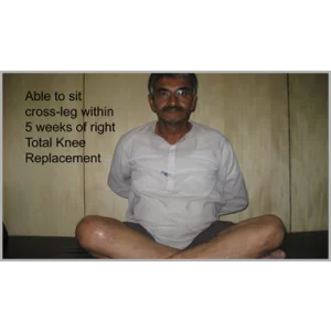 Orthopedic Surgeon Performing Partial Knee Replacement Surgery