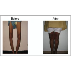 Top Orthopedic Surgeon In Bodakdev